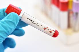 Informácie k celoplošnému testovaniu na COVID-19 - Tájékoztató a COVID-19 országos teszteléséről 1